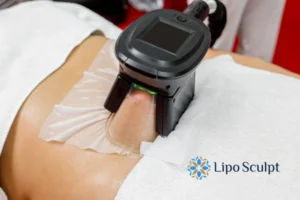 Does Fat Freezing At Home Work? 3 Fat freezing at home from Lipo Sculpt Ashby-de-la-Zouch